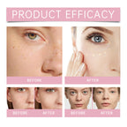🔥 Buy 1 Get 1 Free✨Under Eye Brightener, Brightening Cream Concealer