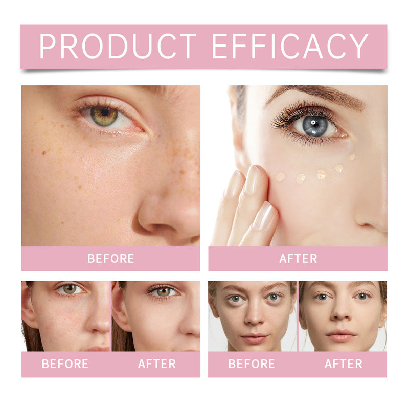 🔥 Buy 1 Get 1 Free✨Under Eye Brightener, Brightening Cream Concealer